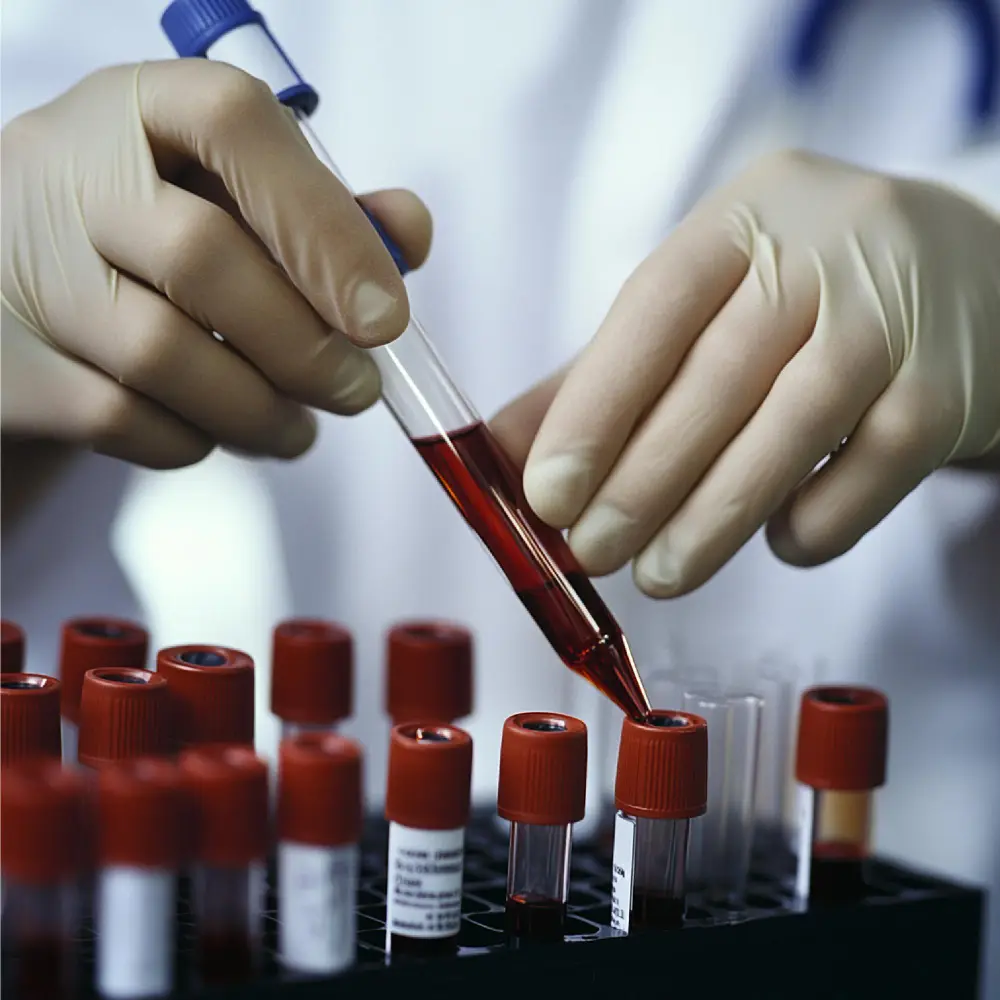 Biosafety-Controlled Sample Processing